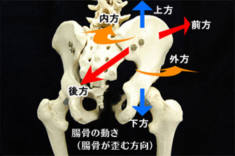 骨盤が歪んだらどうなるの