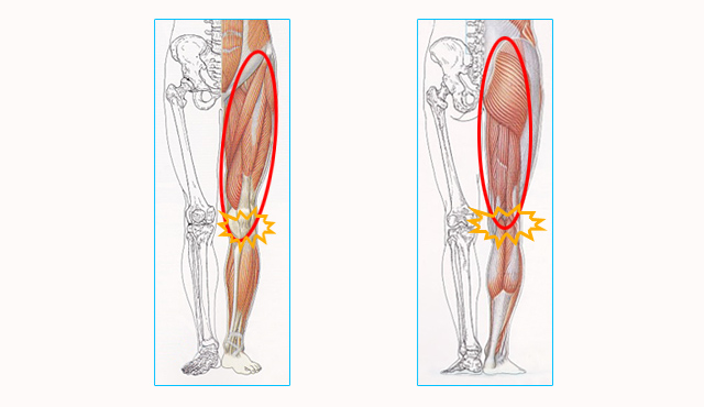 1．初期段階として膝関節に関わる前側と後側の筋肉の緊張が膝痛に影響し、これらの筋肉群が骨盤に付着しています。