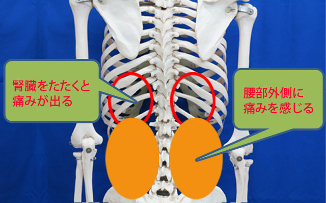 3.腎臓性腰痛